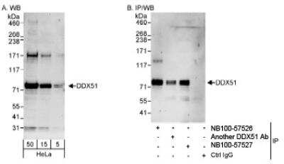 Western Blot: DDX51 Antibody [NB100-57527]