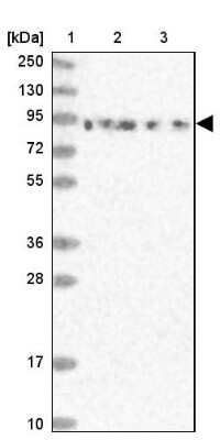 Western Blot: DDX51 Antibody [NBP1-85859]