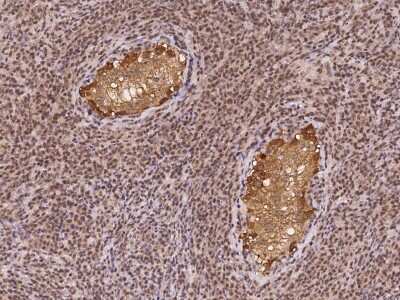 Immunohistochemistry-Paraffin: DDX53 Antibody [NBP2-98111]