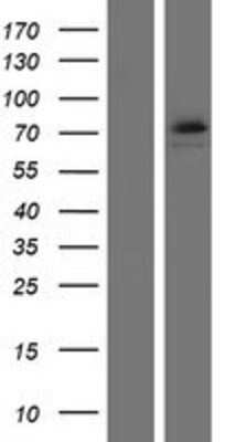 Western Blot: DDX53 Overexpression Lysate [NBP2-04825]