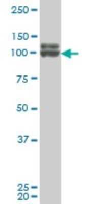 Western Blot: DDX54 Antibody (2E4) [H00079039-M02]