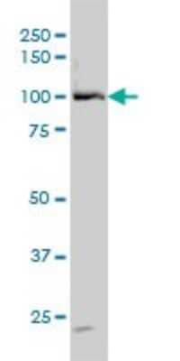 Western Blot: DDX54 Antibody (2H6) [H00079039-M01]