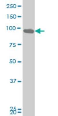 Western Blot: DDX54 Antibody (5B3) [H00079039-M03]