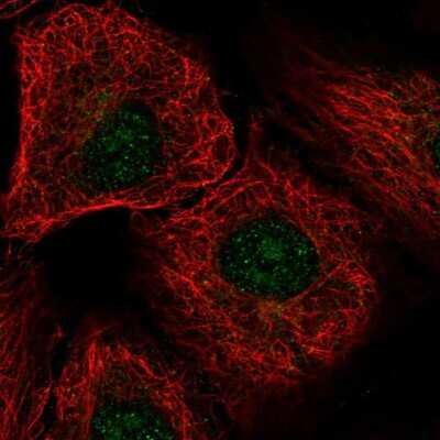 Immunocytochemistry/ Immunofluorescence: DDX54 Antibody [NBP2-57821]