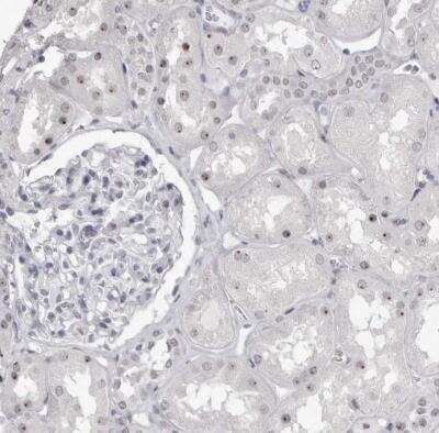 Immunohistochemistry-Paraffin: DDX54 Antibody [NBP1-89028]