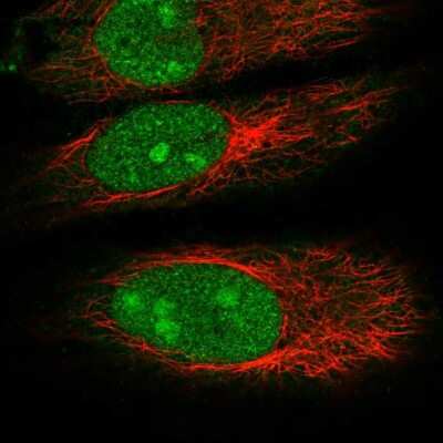 Immunocytochemistry/ Immunofluorescence: DDX55 Antibody [NBP2-58510]