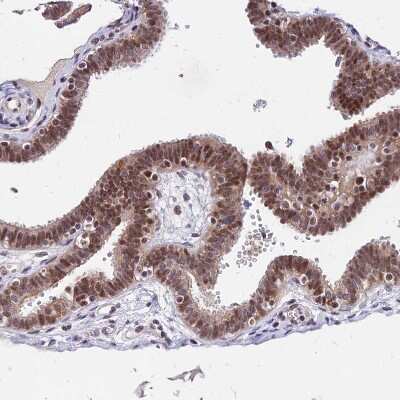 Immunohistochemistry-Paraffin: DDX55 Antibody [NBP2-47490]