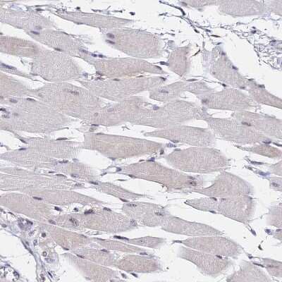 Immunohistochemistry-Paraffin: DDX55 Antibody [NBP2-47490]