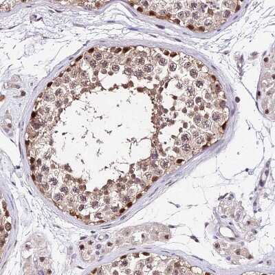 Immunohistochemistry-Paraffin: DDX55 Antibody [NBP2-47490]