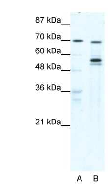 Western Blot: DDX55 Antibody [NBP1-57331]