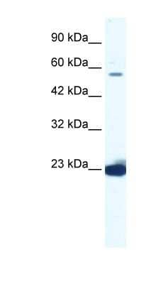 Western Blot: DDX55 Antibody [NBP1-57332]