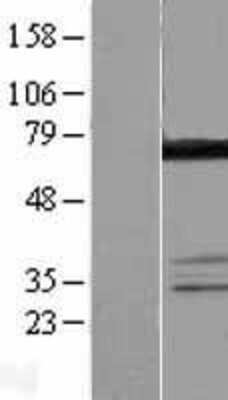 Western Blot: DDX55 Overexpression Lysate [NBL1-09806]