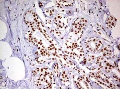 Immunohistochemistry: DDX56 Antibody (OTI2E5) [NBP2-46440]