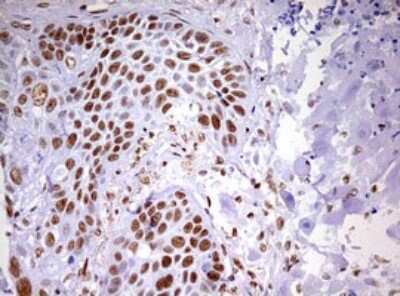 Immunohistochemistry: DDX56 Antibody (OTI2E5) [NBP2-46440]