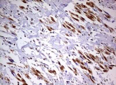 Immunohistochemistry: DDX56 Antibody (OTI2E5) [NBP2-46440]