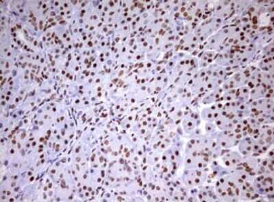 Immunohistochemistry: DDX56 Antibody (OTI2E5) [NBP2-46440]