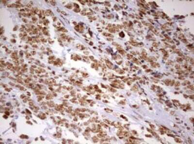 Immunohistochemistry: DDX56 Antibody (OTI2E5) [NBP2-46440]