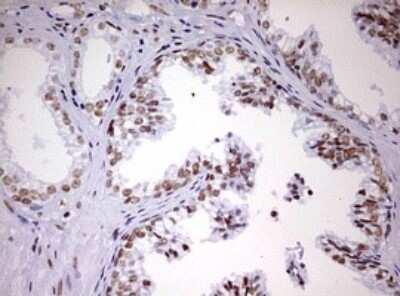 Immunohistochemistry: DDX56 Antibody (OTI2E5) [NBP2-46440]