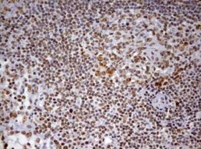 Immunohistochemistry: DDX56 Antibody (OTI2E5) [NBP2-46440]