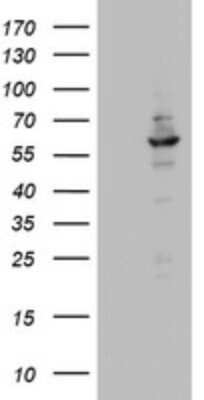 Western Blot: DDX56 Antibody (OTI2E5) [NBP2-46440]