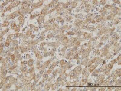Immunohistochemistry-Paraffin: DDX56 Antibody (4C5) [H00054606-M05]