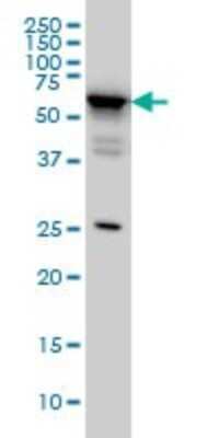 Western Blot: DDX56 Antibody (4C5) [H00054606-M05]