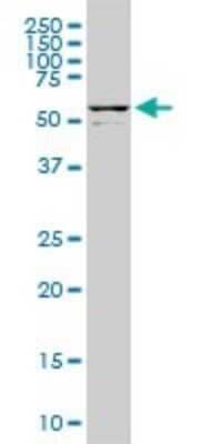 Western Blot: DDX56 Antibody (4C5) [H00054606-M05]