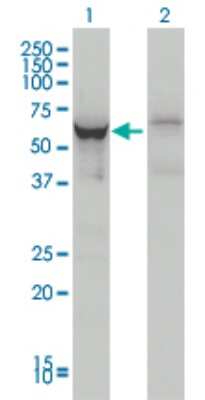 Western Blot: DDX56 Antibody (4C5) [H00054606-M05]