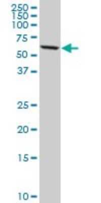 Western Blot: DDX56 Antibody (6B9) [H00054606-M03]
