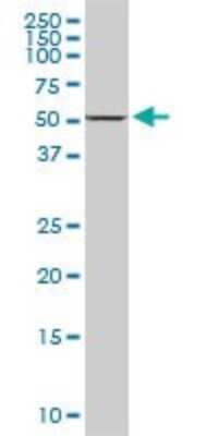 Western Blot: DDX56 Antibody (6B9) [H00054606-M03]