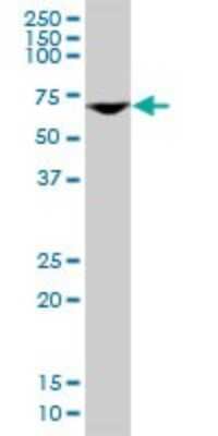 Western Blot: DDX56 Antibody (6B9) [H00054606-M03]