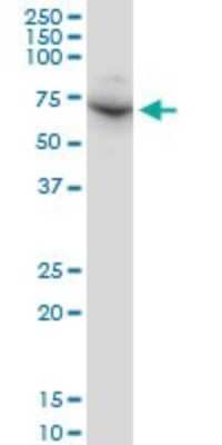 Western Blot: DDX56 Antibody (6B9) [H00054606-M03]