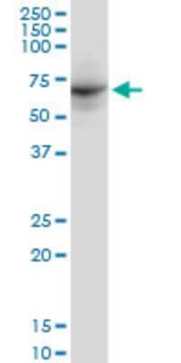Western Blot: DDX56 Antibody (6B9) [H00054606-M03]