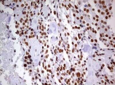 Immunohistochemistry: DDX56 Antibody (OTI2E5) - Azide and BSA Free [NBP2-71964]