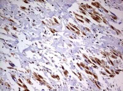 Immunohistochemistry: DDX56 Antibody (OTI2E5) - Azide and BSA Free [NBP2-71964]