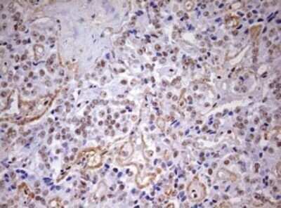 Immunohistochemistry: DDX56 Antibody (OTI2E5) - Azide and BSA Free [NBP2-71964]