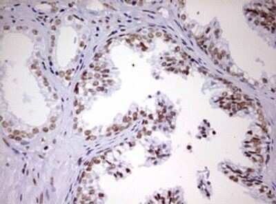Immunohistochemistry: DDX56 Antibody (OTI2E5) - Azide and BSA Free [NBP2-71964]