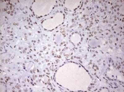 Immunohistochemistry: DDX56 Antibody (OTI2E5) - Azide and BSA Free [NBP2-71964]
