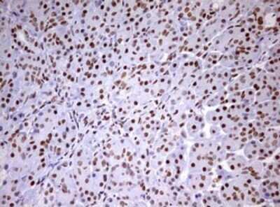 Immunohistochemistry: DDX56 Antibody (OTI2E5) - Azide and BSA Free [NBP2-71964]
