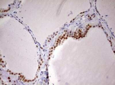 Immunohistochemistry: DDX56 Antibody (OTI2E5) - Azide and BSA Free [NBP2-71964]
