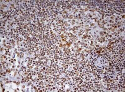 Immunohistochemistry: DDX56 Antibody (OTI2E5) - Azide and BSA Free [NBP2-71964]