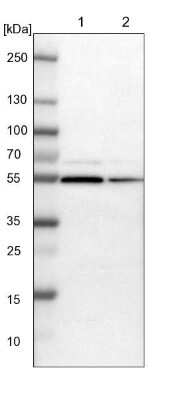 Western Blot: DDX56 Antibody [NBP1-80990]