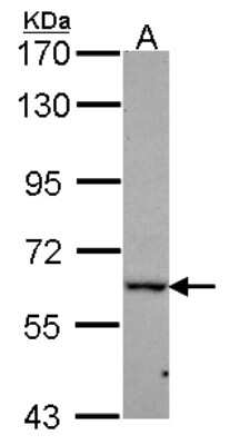 Western Blot: DDX56 Antibody [NBP2-16141]