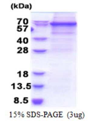 SDS-PAGE: Recombinant Human DDX56 His Protein [NBP2-22989]