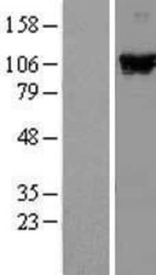 Western Blot: RIG-I Overexpression Lysate [NBL1-09808]