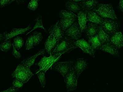 Immunocytochemistry/ Immunofluorescence: DDX59 Antibody [NBP2-97534]