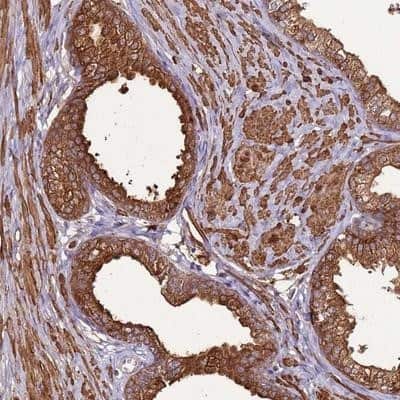 Immunohistochemistry-Paraffin: DDX59 Antibody [NBP2-13909]