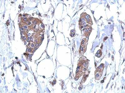 Immunohistochemistry-Paraffin: DDX59 Antibody [NBP2-16142]