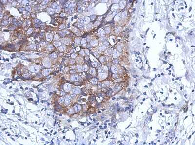 Immunohistochemistry-Paraffin: DDX59 Antibody [NBP2-16143]