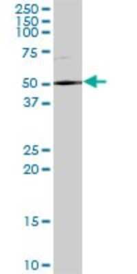 Western Blot: DDX59 Antibody [H00083479-B01P]